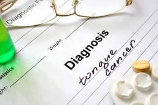 An Oncologist’s Perspective: 10 Key Highlights on Neck-And-Head Cancer 