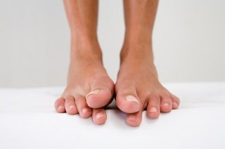 Changes in the Diet & Itchy Toes